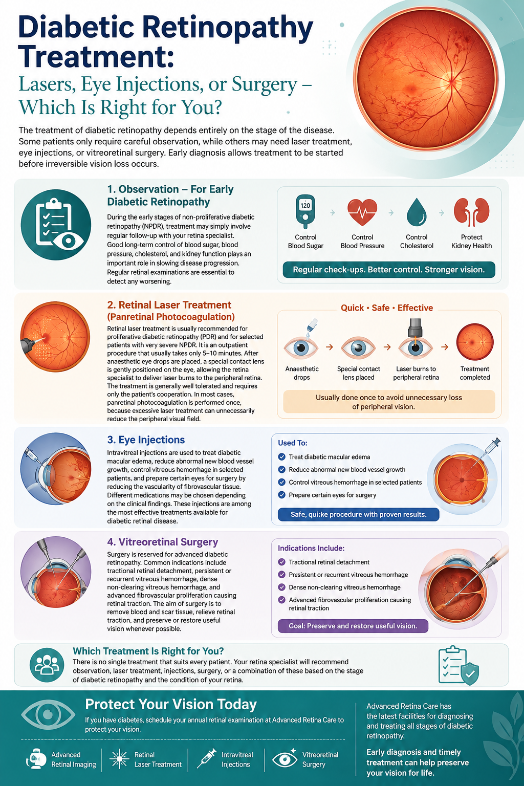 Diabetic Retinopathy Treatment: Lasers, Eye Injections, or Surgery?