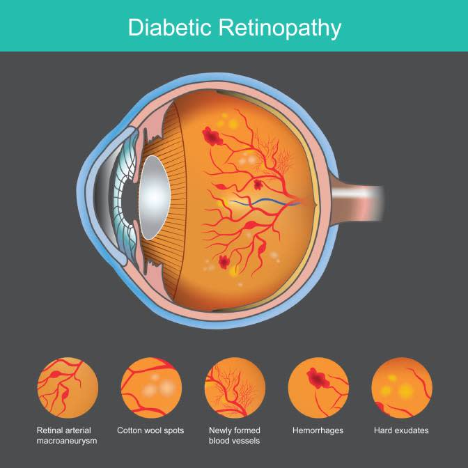 Optical Coherence Tomography