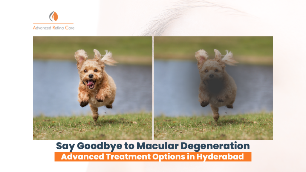 Revolutionary Macular Degeneration Treatment Options at Advanced Retina Care in Hyderabad
