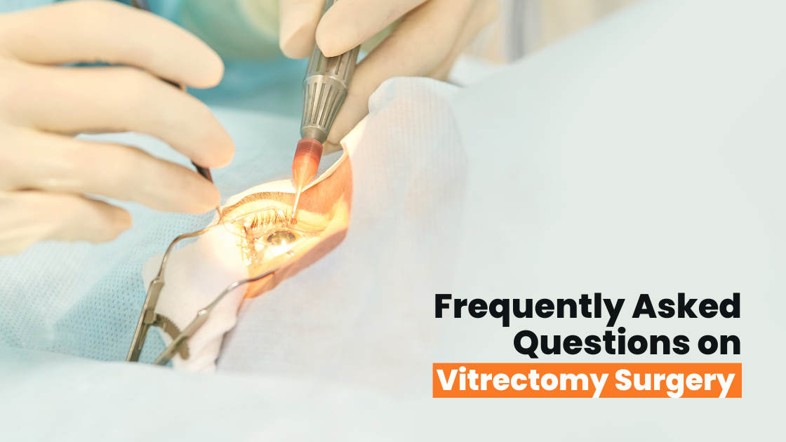 Frequently Asked Questions on Vitrectomy Surgery
